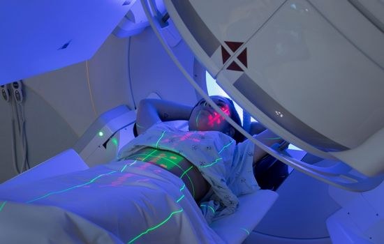 lung cancer treated with radiation