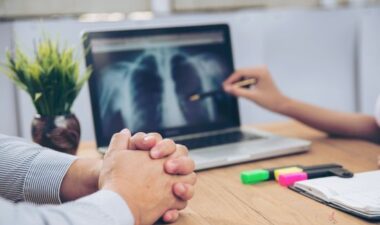 Greater Hope for Improved Outcomes Thanks to Advances in Lung Cancer Treatment