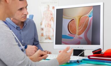 What You Need to Know About Internal Radiation for Prostate Cancer