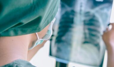 What to Expect If You Have Lung Cancer Surgery