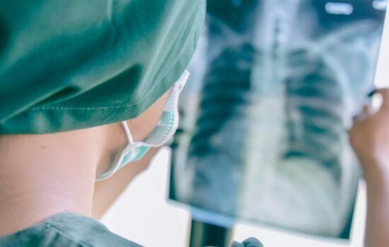 What to Expect If You Have Lung Cancer Surgery