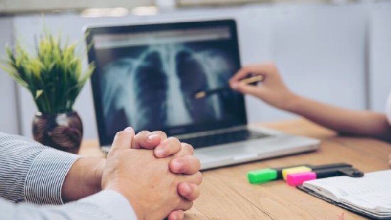 Greater Hope for Improved Outcomes Thanks to Advances in Lung Cancer Treatment