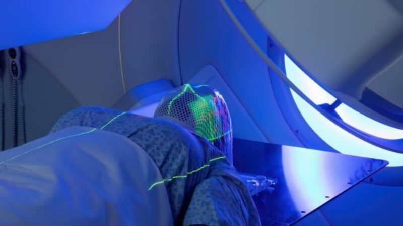 Types of Radiation Therapy Used for Head and Neck Cancers